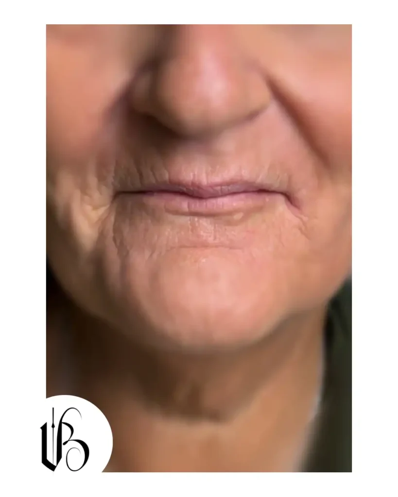 Voor
